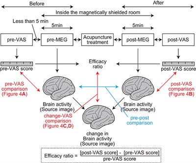 Two Distinct Neural Mechanisms Underlying Acupuncture Analgesia